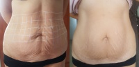 Salon Urody Abacosun Kwidzyn